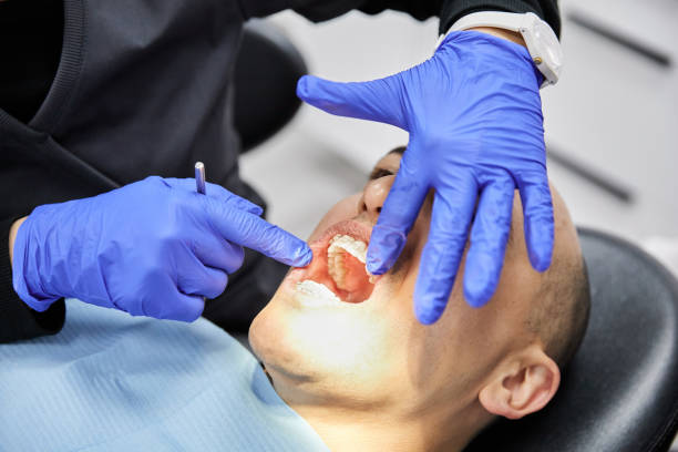 Best Emergency Wisdom Teeth Removal in Stockton, IL